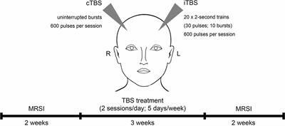 The Impact of Theta-Burst Stimulation on Cortical GABA and Glutamate in Treatment-Resistant Depression: A Surface-Based MRSI Analysis Approach